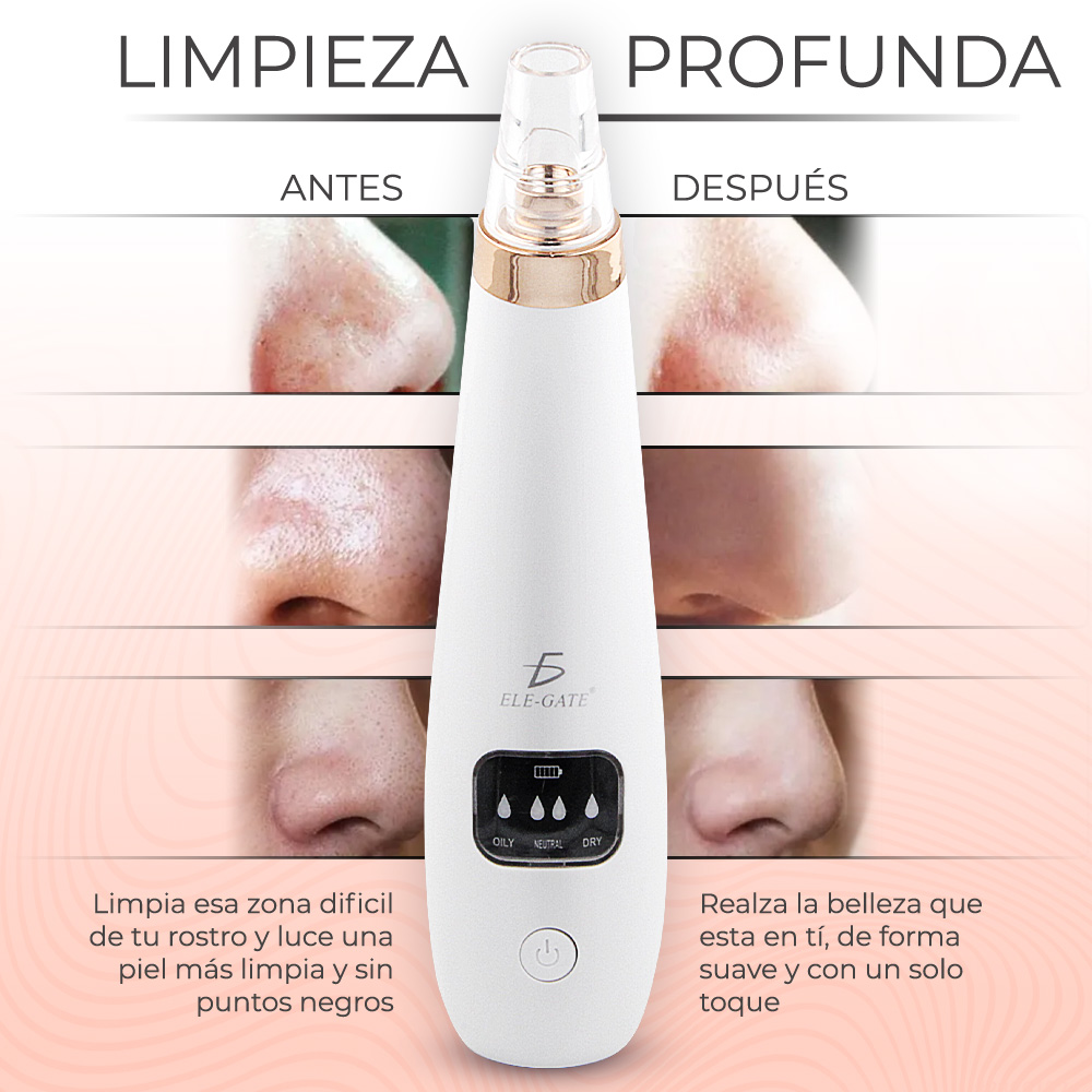 Limpiador De Poros Extractor De Espinillas Por Succión 6 Cabezas