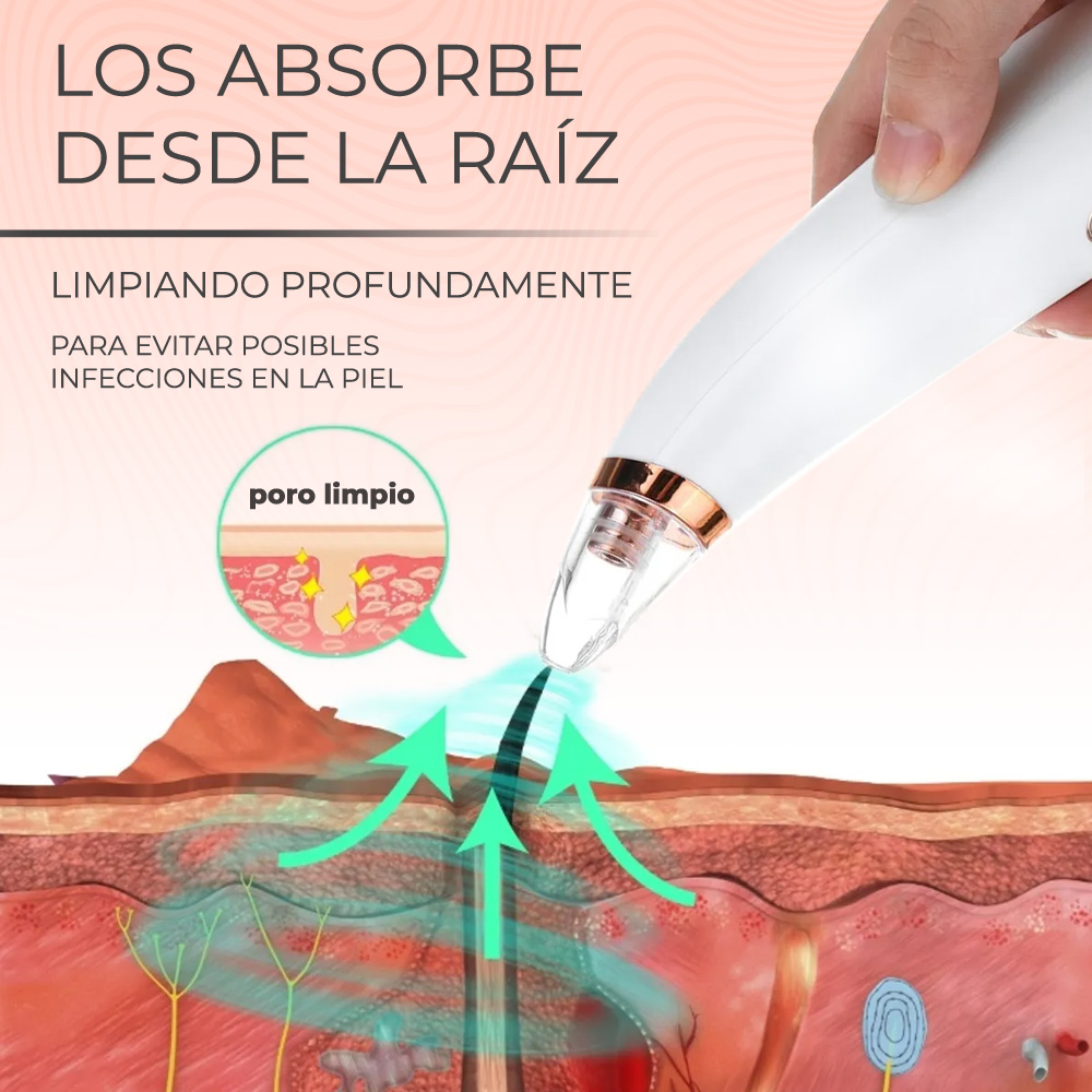 Limpiador De Poros Extractor De Espinillas Por Succión 6 Cabezas