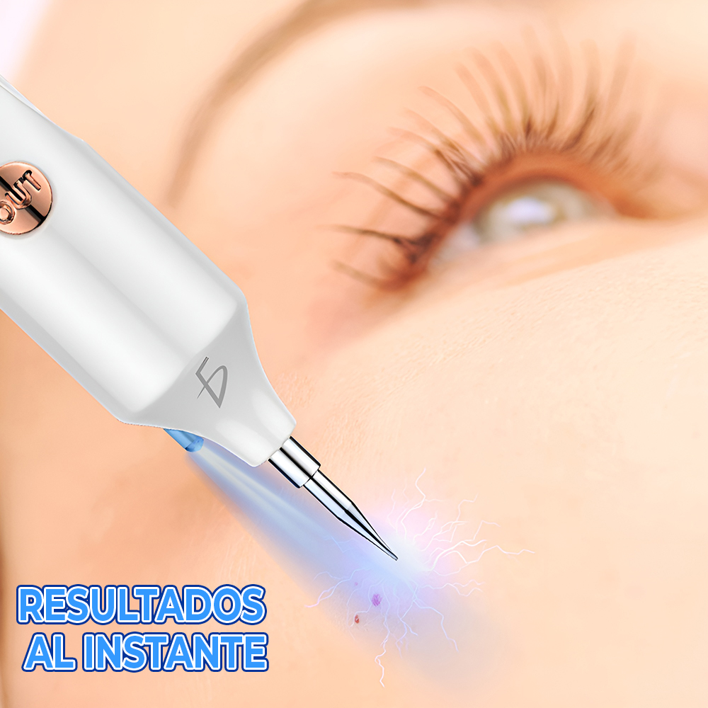 Pluma de eliminación de lunares manchas pecas y removedor de verrugas - Image 3